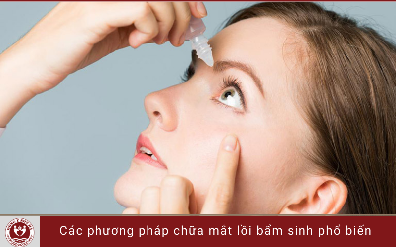 4. Các phương pháp chữa mắt lồi bẩm sinh phổ biến 
