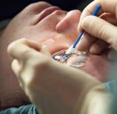 Biến chứng sau mổ cận thị, mổ lé (lác) - Cách phục hồi phẫu thuật hỏng