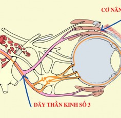Liệt dây thần kinh số 3 gây sụp mí mắt - Nguyên nhân do đâu?