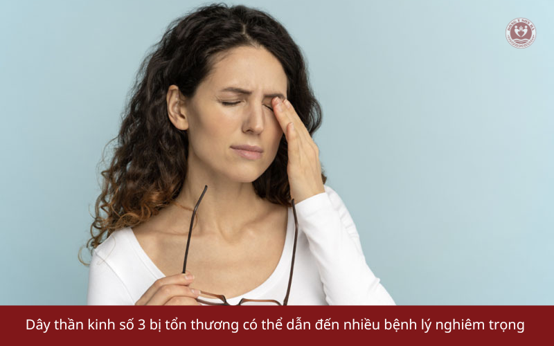 Các bệnh lý liên quan đến dây thần kinh số 3