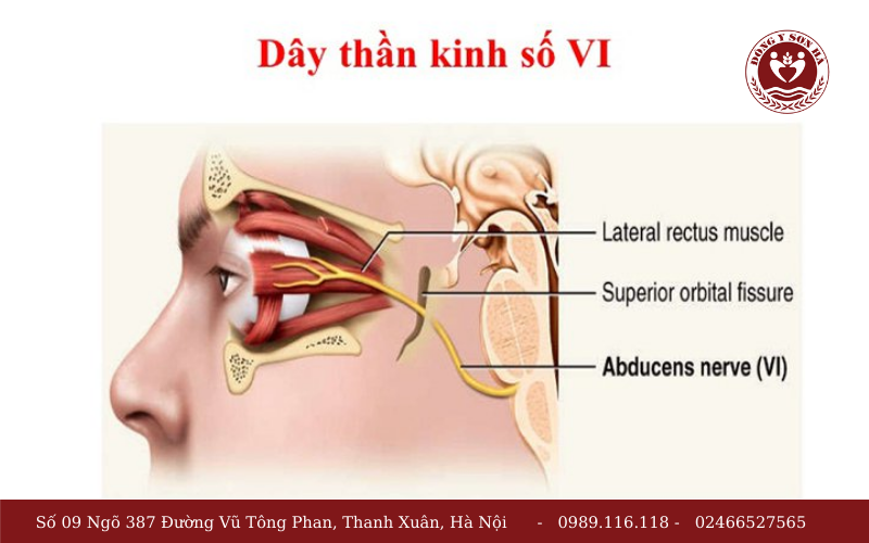 1. Dây thần kinh số 6 là gì?