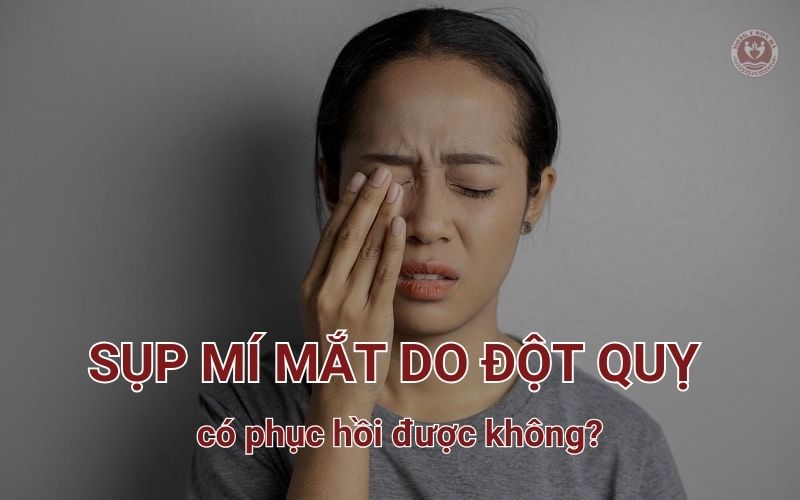 Sụp mí mắt do đột quỵ có thể hồi phục không?