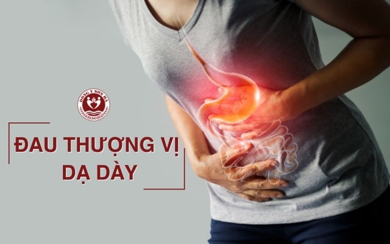 Đau thượng vị dạ dày là gì?
