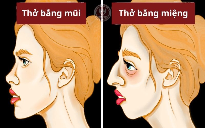 2. Há miệng khi ngủ có nguy hiểm không?