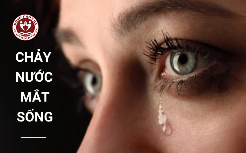 Chảy nước mắt sống  - Dấu hiệu bất thường về mắt