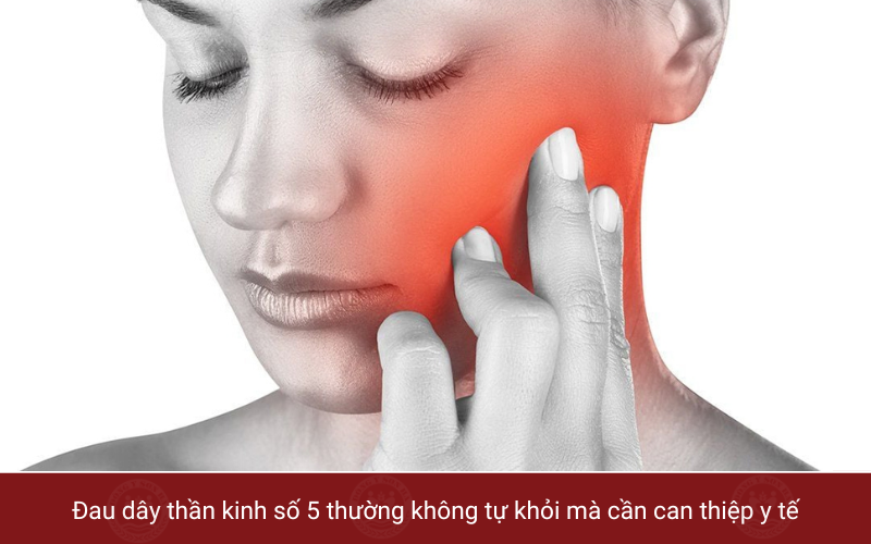 2. Đau dây thần kinh số 5 có chữa được không?