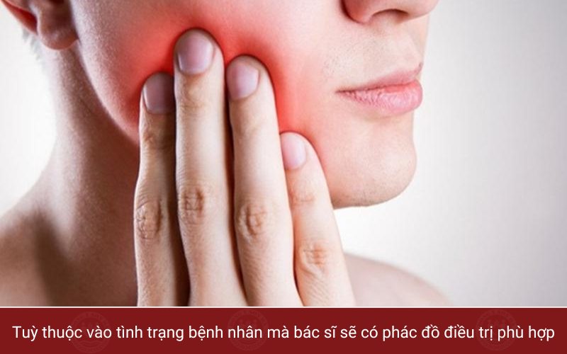 3. Cách làm giảm đau dây thần kinh số 5