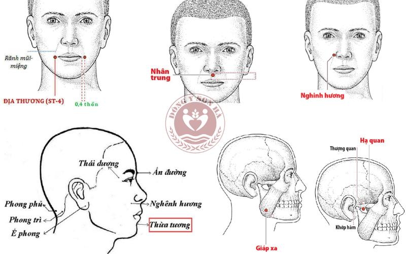 Mặt lệch bấm huyệt nào?