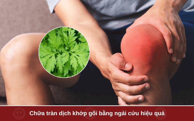 2. Chữa tràn dịch khớp gối bằng ngải cứu hiệu quả