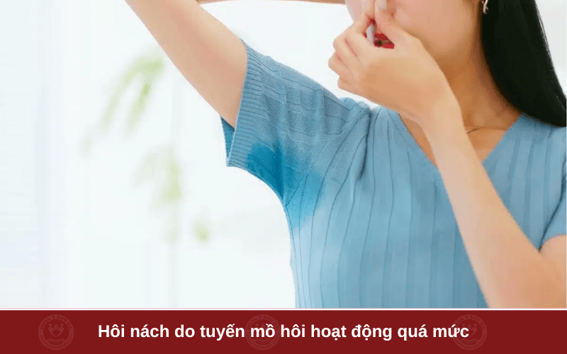 Nguyên nhân gây hôi nách