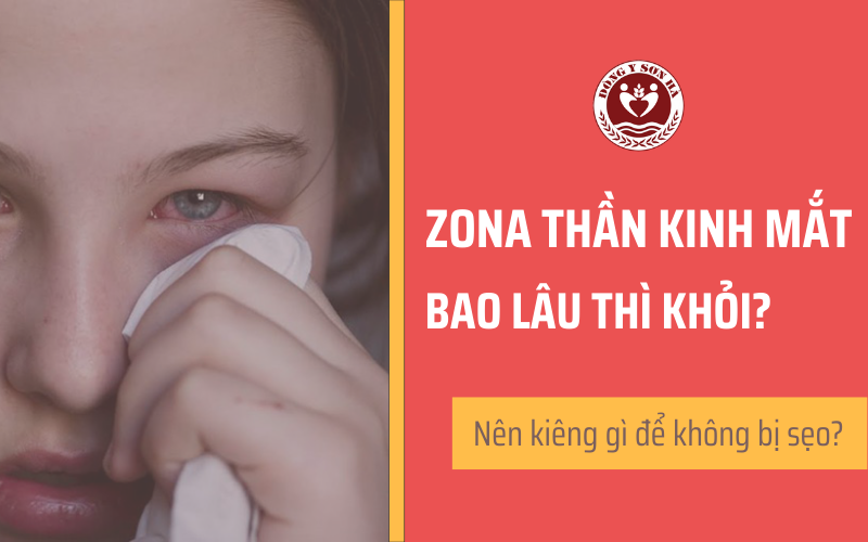 Làm cách nào để phòng ngừa bệnh zona ở mắt? 
