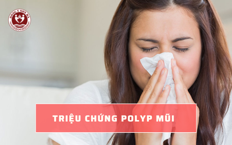 Các triệu chứng của bệnh polyp mũi