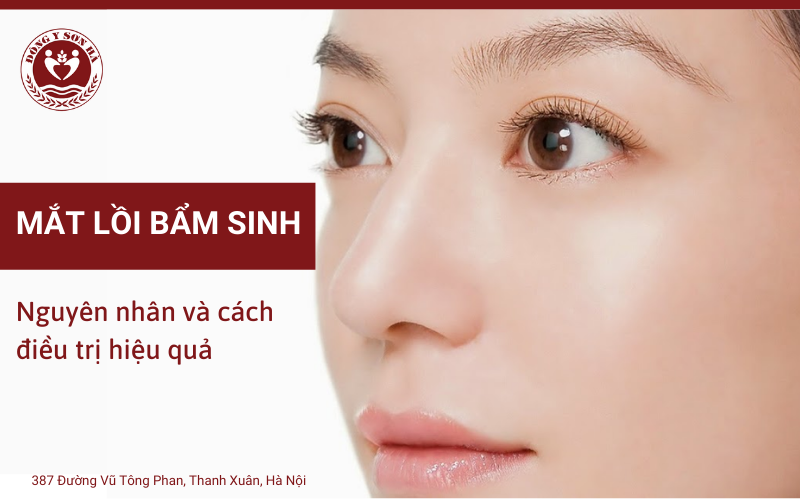 Có những biến chứng gì có thể xảy ra do mắt lồi bẩm sinh?
