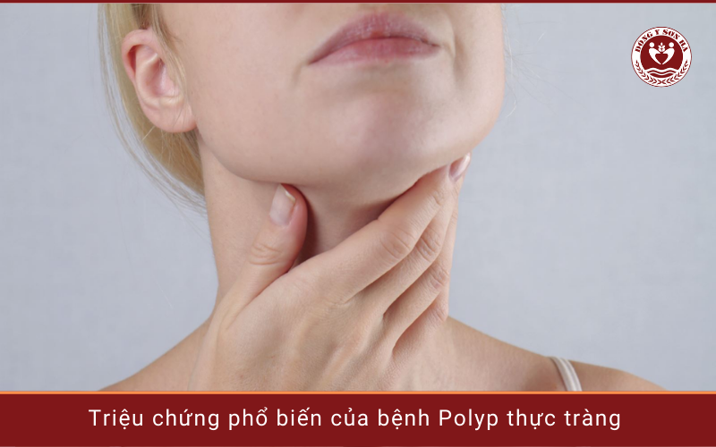 3. Các triệu chứng của polyp thực quản 