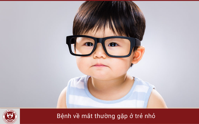 3. Bệnh về mắt ở trẻ em thường gặp nhất